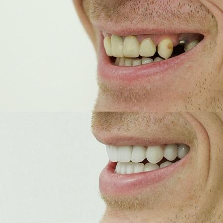 Фотография Белая Мята dental studio 3