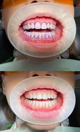 Фотография Белая Мята dental studio 5