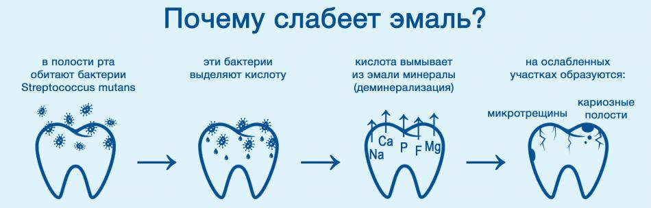 Реминерализация эмали: показания к процедуре.