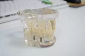 Фотография Ультра-Дент 3